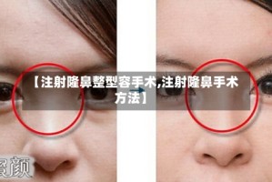 【注射隆鼻整型容手术,注射隆鼻手术方法】