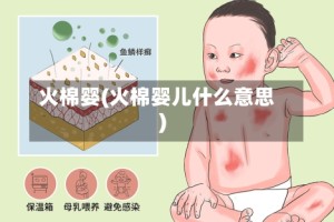 火棉婴(火棉婴儿什么意思)