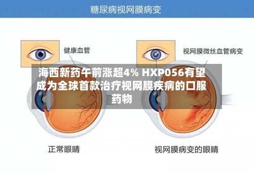 海西新药午前涨超4% HXP056有望成为全球首款治疗视网膜疾病的口服药物-第2张图片