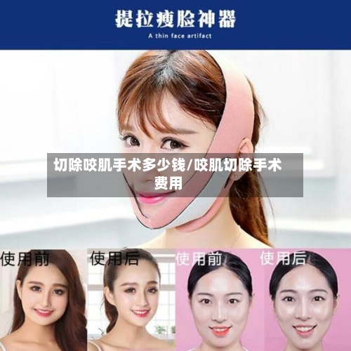 切除咬肌手术多少钱/咬肌切除手术费用-第3张图片