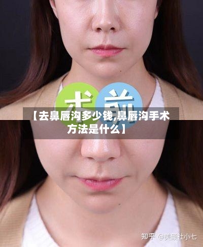 【去鼻唇沟多少钱,鼻唇沟手术方法是什么】-第2张图片