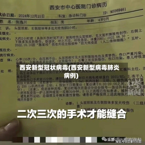 西安新型冠状病毒(西安新型病毒肺炎病例)-第1张图片